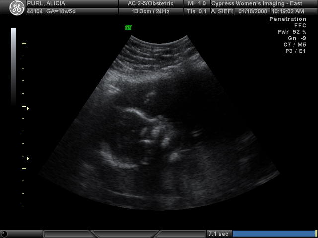 Profile of Baby Purl
