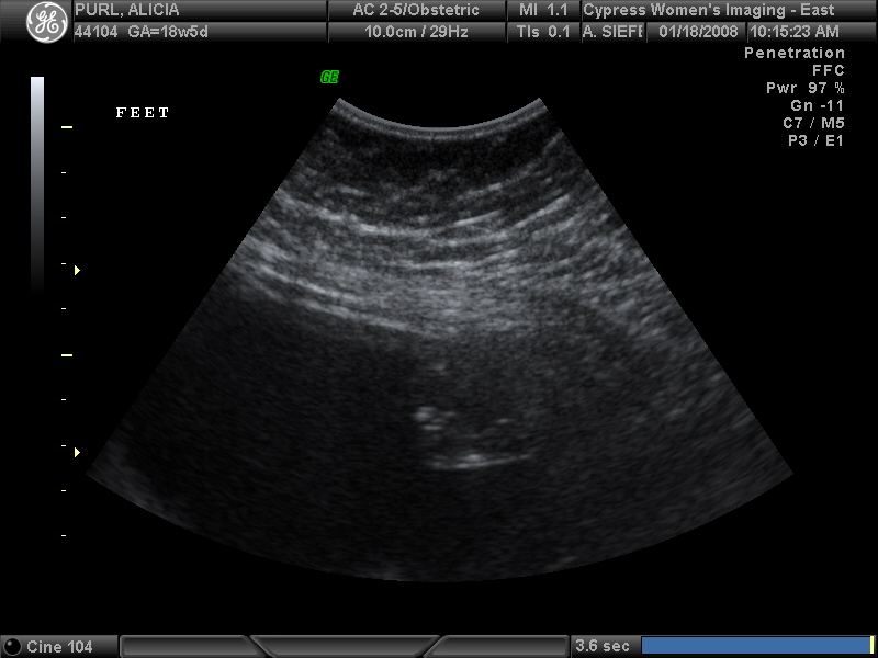 Baby Purl foot