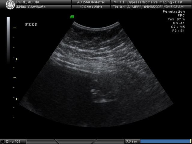 Baby Purl foot